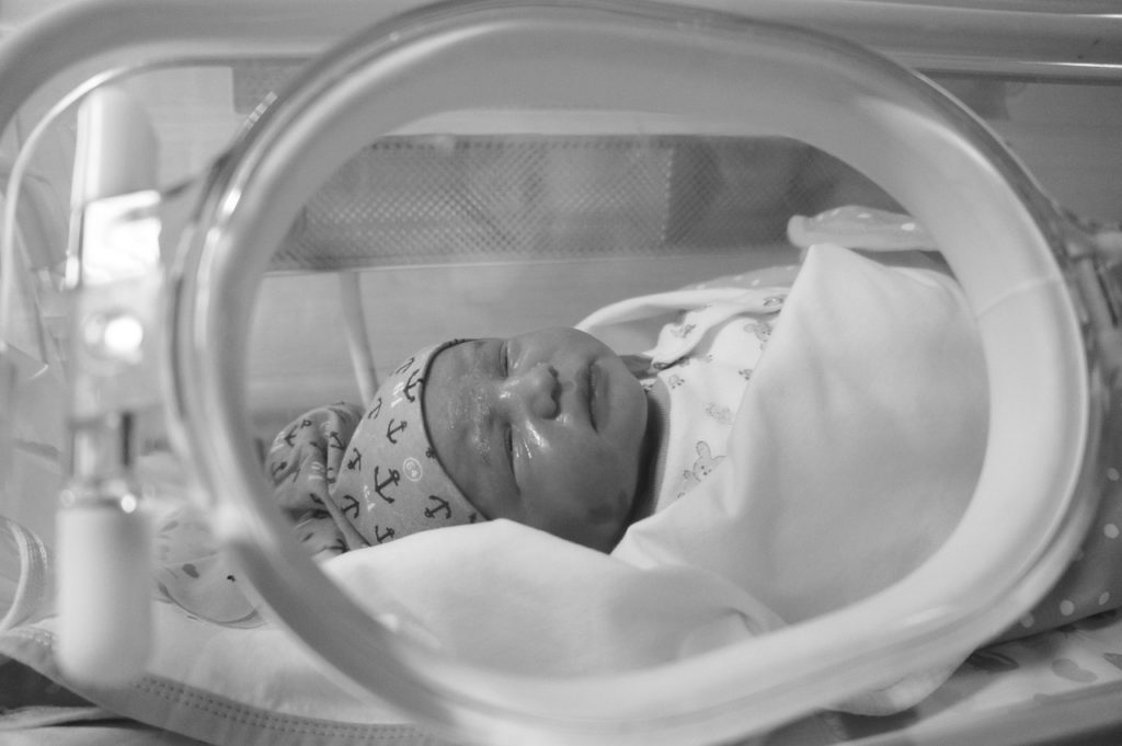 Baby nach Geburt auf der Intensivstation.